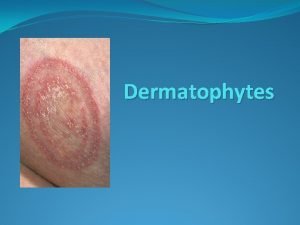 Dermatophytes Dermatophytes are a group of closely related