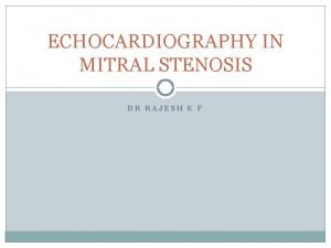 ECHOCARDIOGRAPHY IN MITRAL STENOSIS DR RAJESH K F