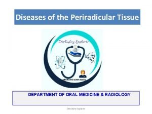 Periradicular diseases
