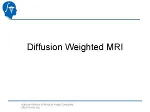 Fractional anisotropy meaning