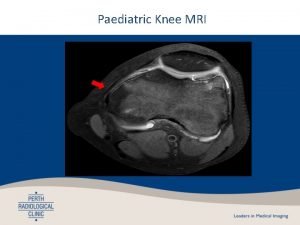 Indications for knee mri