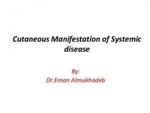 Cutaneous Manifestation of Systemic disease By Dr Eman