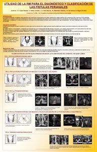 Fosa isquirectal