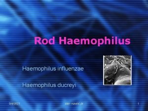 Rod Haemophilus influenzae Haemophilus ducreyi 342021 alen vukeli