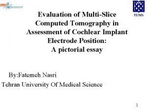 Evaluation of MultiSlice Computed Tomography in Assessment of