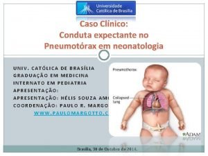 Caso Clnico Conduta expectante no Pneumotrax em neonatologia