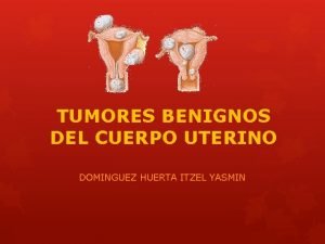 TUMORES BENIGNOS DEL CUERPO UTERINO DOMINGUEZ HUERTA ITZEL