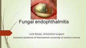 Fungal endophthalmitis Leila Rezaei vitreoretinal surgeon Assistant professor