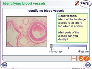 Identifying blood vessels 1 of 33 Boardworks Ltd