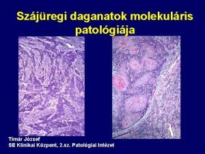 Szjregi daganatok molekulris patolgija Tmr Jzsef SE Klinikai