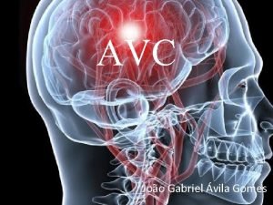 AVC Joo Gabriel vila Gomes Acidente Vascular Cerebral