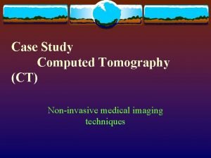 Case Study Computed Tomography CT Noninvasive medical imaging