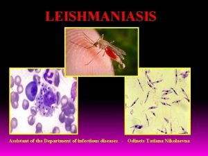 LEISHMANIASIS Assistant of the Department of infectious diseases