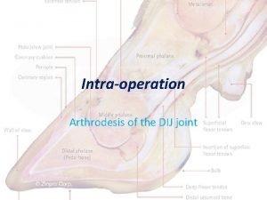 Dij joint Dij joint