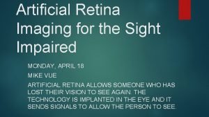 Artificial Retina Imaging for the Sight Impaired MONDAY