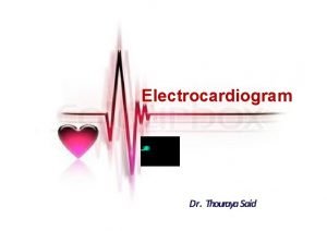 Ecg small square time
