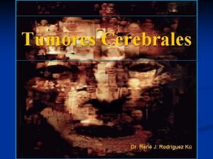 Tumores Cerebrales Dr Ren J Rodrguez K Tumores