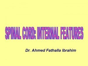 Vestibulospinal tract origin
