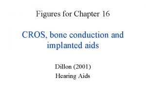 Cros bone
