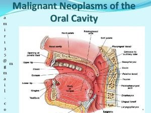 Malignant Neoplasms of the Oral Cavity a m