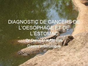 DIAGNOSTIC DE CANCERS DE LOESOPHAGE ET DE LESTOMAC