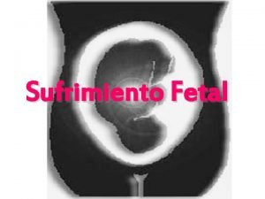Sufrimiento Fetal Sufrimiento Fetal Perturbacin metablica compleja debida