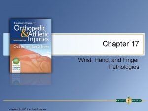 Wrist joint clinical anatomy