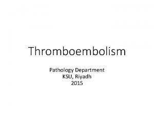 Thromboembolism Pathology Department KSU Riyadh 2015 Objectives Understand