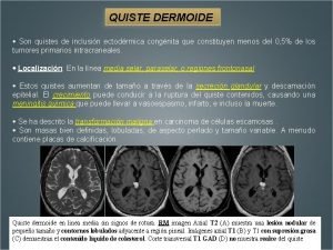 QUISTE DERMOIDE Son quistes de inclusin ectodrmica congnita