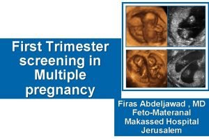 First Trimester screening in Multiple pregnancy Firas Abdeljawad
