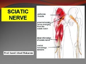 Sciatic nerve palsy