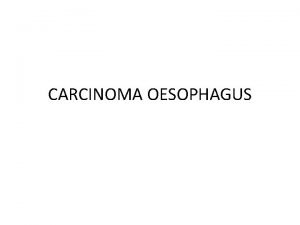 CARCINOMA OESOPHAGUS BENIGN TUMORS AND CYSTS i Leiomyoma