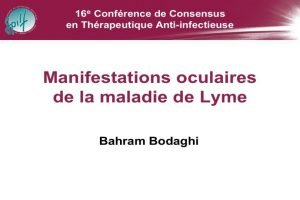 Manifestations ophtalmologiques de la maladie de Lyme B