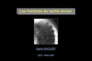 Les fractures du rachis dorsal Samir KHOURY DES