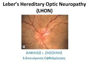 What is the Lebers Hereditary Optic Neuropathy LHON