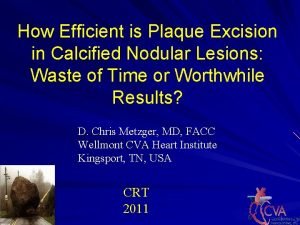 How Efficient is Plaque Excision in Calcified Nodular