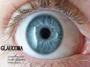 GLAUCOMA Luisa Gonzalez Paula Granados Deisy Lopez CIRCULACION