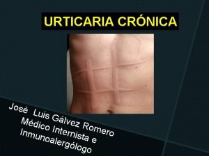 URTICARIA CRNICA Jos Luis Md Glvez ico In