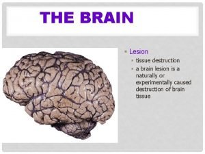 THE BRAIN Lesion tissue destruction a brain lesion