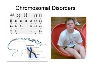 Chromosomal Disorders Chromosomal disorders Having mild to severe