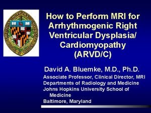 How to Perform MRI for Arrhythmogenic Right Ventricular