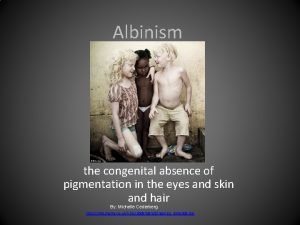 Albinism the congenital absence of pigmentation in the