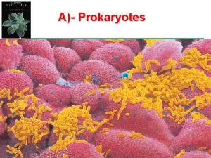 A Prokaryotes A Prokaryotes l It includes two