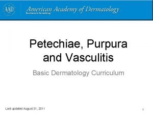 Petechiae Purpura and Vasculitis Basic Dermatology Curriculum Last