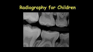 Occlusal radiograph of mandible
