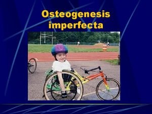 Regional odontodysplasia