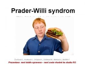 PraderWilli syndrom 1956 vcart lkai profesor A Prader