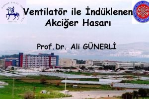 Ventilatr ile ndklenen Akcier Hasar Prof Dr Ali