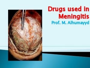 Drugs used in Meningitis Prof M Alhumayyd Objectives