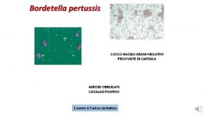 Bordetella pertussis COCCOBACILLI GRAMNEGATIVI PROVVISTE DI CAPSULA AEROBI